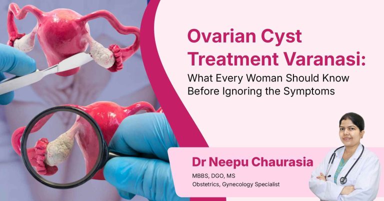 Ovarian Cyst Treatment Varanasi