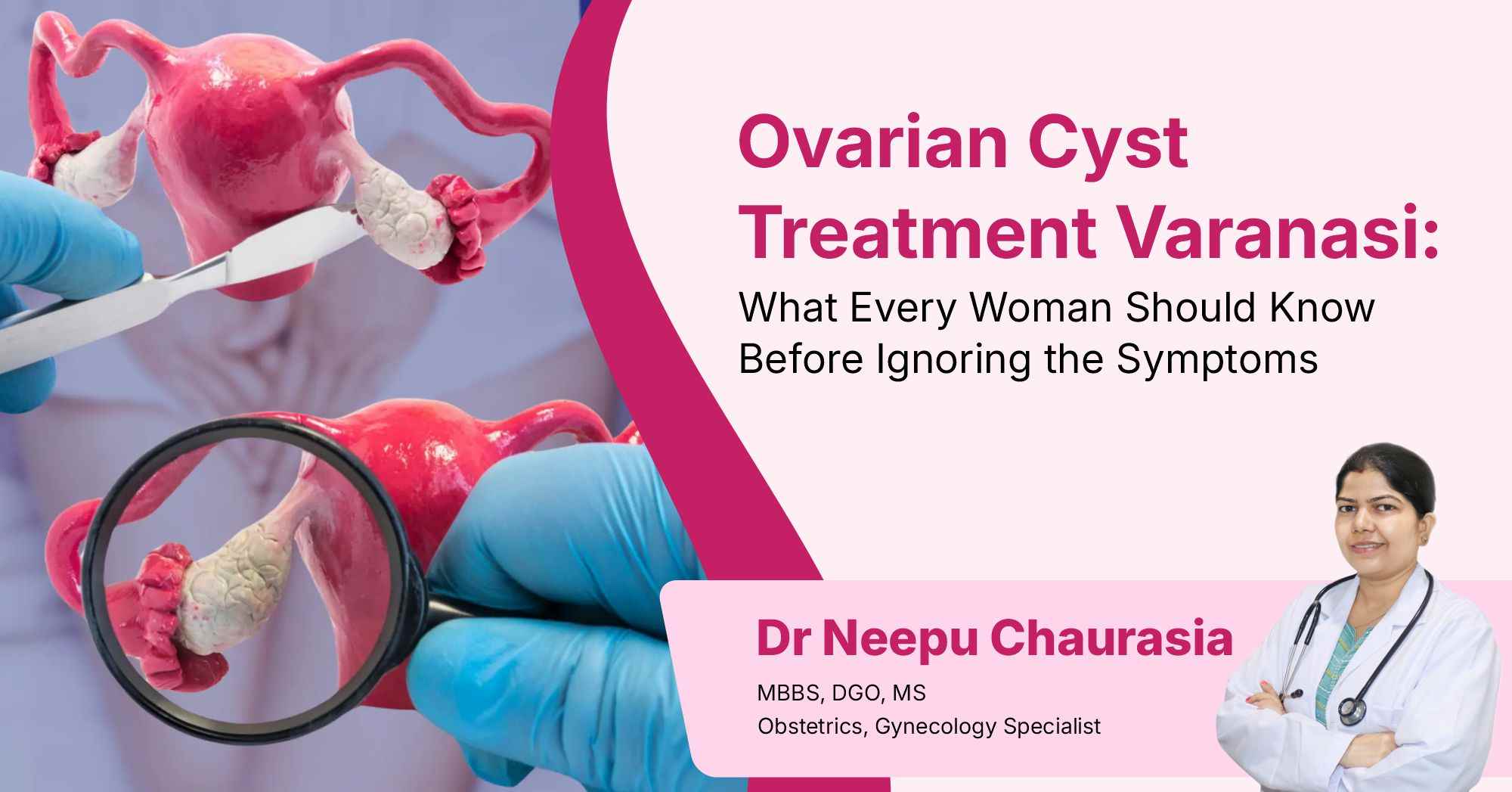 Ovarian Cyst Treatment Varanasi